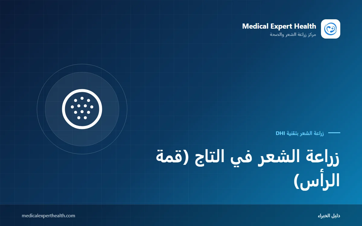 زراعة الشعر في التاج (قمة الرأس): اتجاه الدوامة وتخطيط البصيلات والجدول الزمني