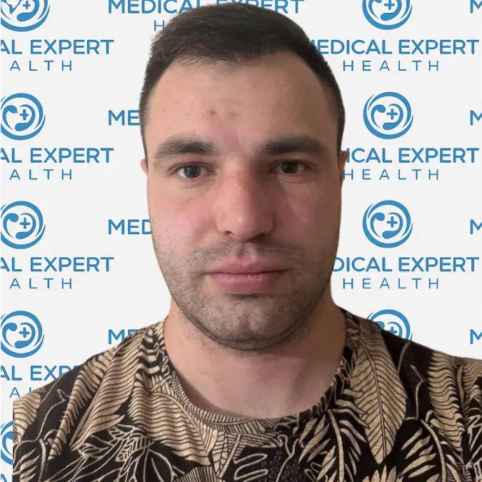 FUE Hair Transplant · Before and after - After