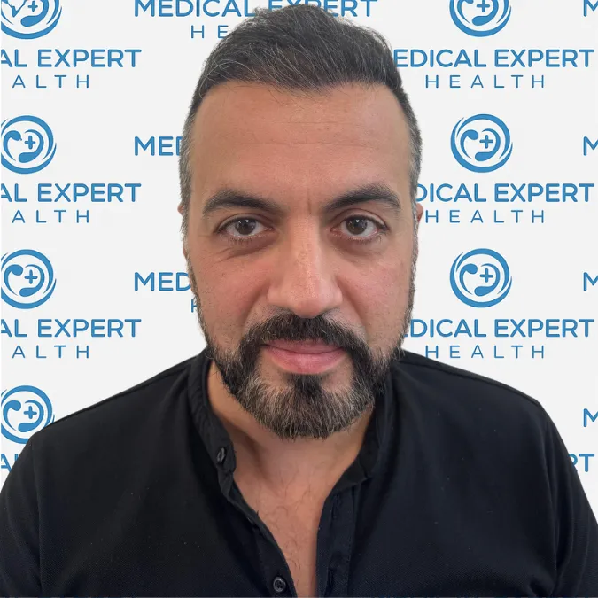 FUE Hair Transplant · Before and after - After