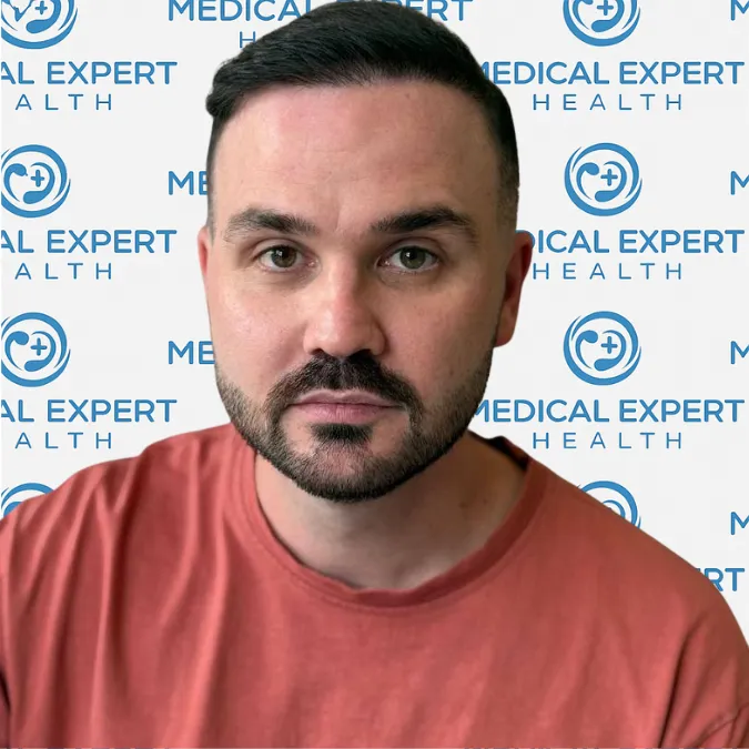 FUE Hair Transplant · Before and after - After
