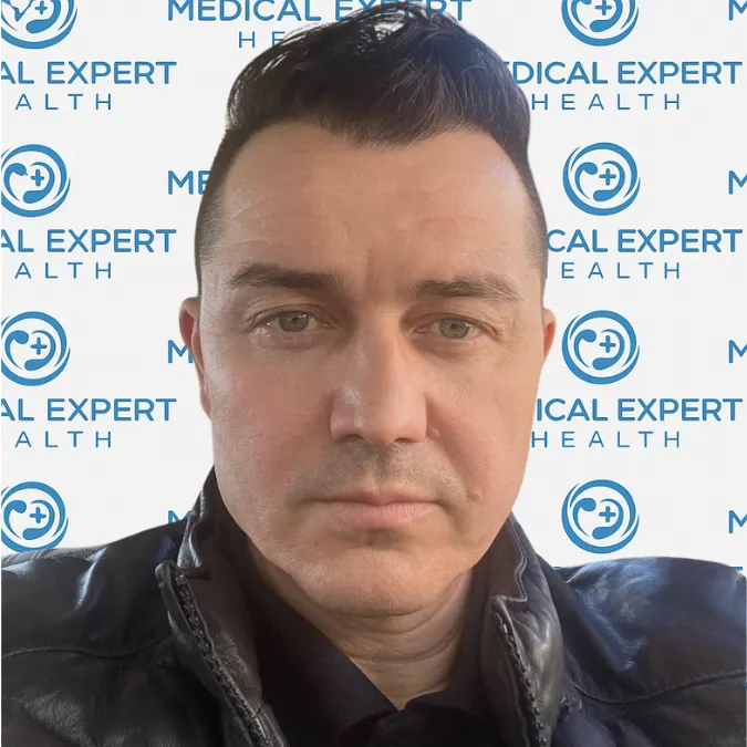FUE Hair Transplant · Before and after - After